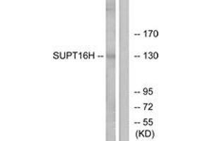 Western blot analysis of extracts from HepG2/Jurkat cells, using SUPT16H Antibody. (SUPT16H 抗体  (AA 941-990))