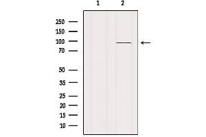 Western Blotting (WB) image for anti-Vav 1 Oncogene (VAV1) (N-Term) antibody (ABIN6265950)