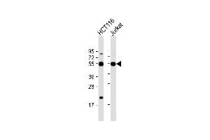 All lanes : Anti-CHEK2 Antibody (N-term) at 1:1000 dilution Lane 1: HC whole cell lysate Lane 2: Jurkat whole cell lysate Lysates/proteins at 20 μg per lane.