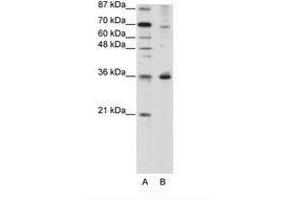 Image no. 1 for anti-Forkhead Box Q1 (FOXQ1) (N-Term) antibody (ABIN202434) (FOXQ1 抗体  (N-Term))