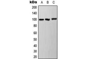 Western blot analysis of Ah Receptor (pS36) expression in A431 (A), HepG2 (B), NIH3T3 (C) whole cell lysates.