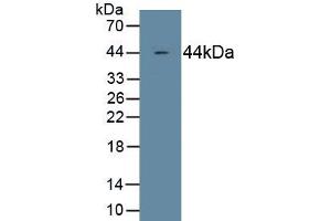 Detection of Recombinant C4c, Human using Monoclonal Antibody to Complement Component 4c (C4c) (Complement C4c 抗体  (AA 19-333))