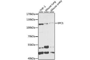 Western blot analysis of extracts of various cell lines, using EPC1 antibody (ABIN2562436) at 1:1000 dilution.