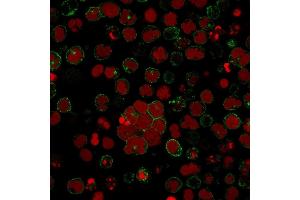 Immunofluorescence staining of MOLT-4 cells using CD2 Mouse Monoclonal Antibody (LFA2/600) followed by goat anti-Mouse IgG conjugated to CF488 (green). (CD2 抗体)