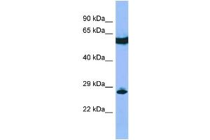 Host: Rabbit Target Name: C22orf13 Sample Type: RPMI-8226 Whole Cell lysates Antibody Dilution: 1. (C22orf13 抗体  (Middle Region))