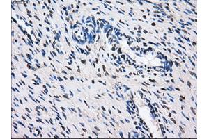 Immunohistochemical staining of paraffin-embedded Ovary tissue using anti-GBE1 mouse monoclonal antibody. (GBE1 抗体)