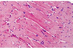 Human Skeletal Muscle: Formalin-Fixed, Paraffin-Embedded (FFPE) (BID 抗体  (C-Term))