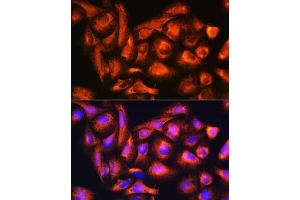 Immunofluorescence analysis of U2OS cells using B9D1 Rabbit pAb (ABIN6133363, ABIN6137409, ABIN6137410 and ABIN6223982) at dilution of 1:100.