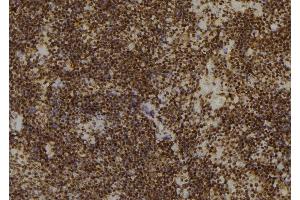 ABIN6266451 at 1/100 staining Mouse spleen tissue by IHC-P. (CDC25A 抗体  (pSer76))