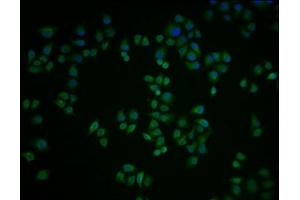Immunofluorescence staining of Hela cells with ABIN7164665 at 1:100, counter-stained with DAPI. (PIBF1 抗体  (AA 1-757))