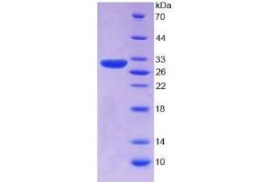 SDS-PAGE of Protein Standard from the Kit (Highly purified E. (SERPINB3 CLIA Kit)