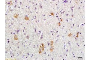 Formalin-fixed and paraffin embedded rat brain tissue labeled with Anti-APC/Adenomatous Polyposis Coli Polyclonal Antibody, Unconjugated  at 1:200 followed by conjugation to the secondary antibody, (SP-0023), and DAB staining (APC 抗体  (AA 2751-2843))
