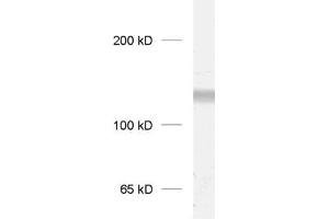 dilution: 1 : 1000, sample: crude synaptosomal fraction of rat brain (P2) (GRIK3 抗体  (C-Term))