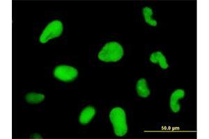Immunofluorescence of monoclonal antibody to ZNF207 on HeLa cell. (ZNF207 抗体  (AA 1-110))