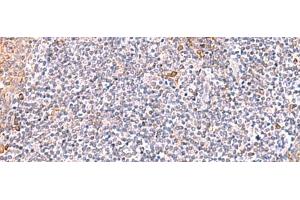 Immunohistochemistry of paraffin-embedded Human tonsil tissue using ITSN2 Polyclonal Antibody at dilution of 1:40(x200) (Intersectin 2 抗体)