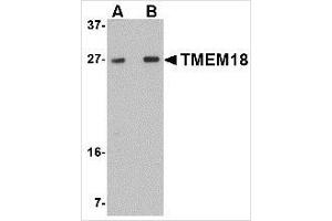 Western blot analysis of TMEM18 in rat brain lysate with TMEM18 antibody at (A) 0. (Transmembrane Protein 18 (TMM18) (C-Term) 抗体)