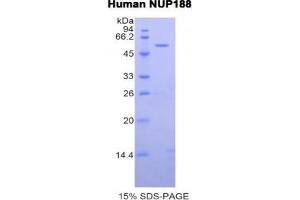 SDS-PAGE analysis of Human Nucleoporin 188 kDa Protein. (NUP188 蛋白)