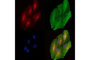ABIN6261215 and ABIN6277963 staining  cells by IF/ICC. (DAB2 抗体  (C-Term))