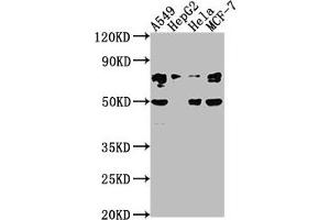 Western Blot Positive WB detected in: A549 whole cell lysate, HepG2 whole cell lysate, Hela whole cell lysate, MCF-7 whole cell lysate All lanes: LEO1 antibody at 1:2000 Secondary Goat polyclonal to rabbit IgG at 1/50000 dilution Predicted band size: 76, 69 kDa Observed band size: 76 kDa (LEO1 抗体  (AA 2-24))