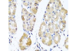 Immunohistochemistry of paraffin-embedded Human stomach using MRPL11 Polyclonal Antibody at dilution of 1:100 (40x lens). (MRPL11 抗体)