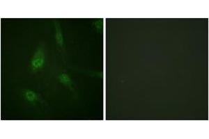 Immunofluorescence analysis of HeLa cells, using NFAT4 (Phospho-Ser165) Antibody. (NFATC3 抗体  (pSer165))