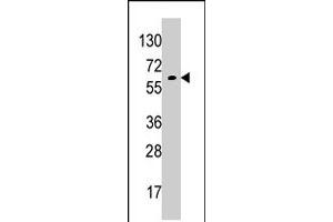 Western blot analysis of GPC6 polyclonal antibody  in K-562 cell line lysates (35 ug/lane). (Glypican 6 抗体  (AA 24-46))