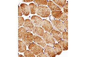 Paraformaldehyde-fixed, paraffin embedded human skeletal muscle tissue, Antigen retrieval by boiling in sodium citrate buffer (pH6. (Raptor 抗体)
