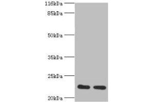 Western blot All lanes: RERG antibody at 2 μg/mL Lane 1: Mouse thymus tissue Lane 2: Rat lung tissue Secondary Goat polyclonal to rabbit at 1/10000 dilution Predicted band size: 23, 21 kDa Observed band size: 23 kDa (RERG 抗体  (AA 1-199))
