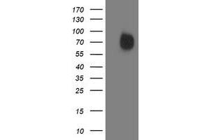 Western Blotting (WB) image for anti-Interferon Regulatory Factor 6 (IRF6) antibody (ABIN1498903) (IRF6 抗体)