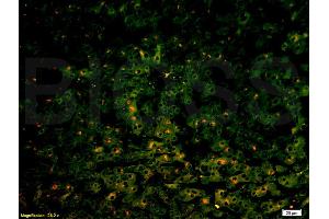 Immunofluorescence (IF) image for anti-ATP-Binding Cassette, Sub-Family C (CFTR/MRP), Member 2 (ABCC2) (AA 485-615) antibody (ABIN737541)