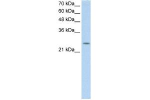 WB Suggested Anti-C5orf4 Antibody Titration:  0. (C5ORF4 抗体  (N-Term))