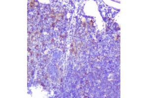 IHC analysis of Caspase-2 using anti-Caspase-2 antibody (ABIN6719550).