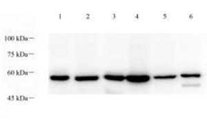Western blot analysis of p38IP (ABIN7075954) at dilution of 1: 1000,Lane 1: Mouse testis tissue lysate,Lane 2: Mouse thymus tissue lysate,Lane 3: Mouse lung tissue lysate,Lane 4: Rat testis tissue lysate,Lane 5: Rat thymus tissue lysate,Lane 6: Rat lung tissue lysate (Transcription Factor SPT20 Homolog (SUPT20H) 抗体)