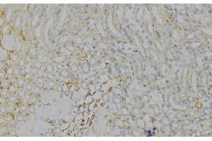 ABIN6276781 at 1/100 staining Human gastric tissue by IHC-P. (HMGCR 抗体  (N-Term))