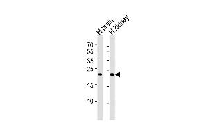 All lanes : Anti-FGF9 Antibody at 1:4000 dilution Lane 1: human brain lysates Lane 2: human kidney lysates Lysates/proteins at 20 μg per lane. (FGF9 抗体)