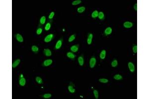 Immunofluorescence staining of Hela cells with ABIN7172791 at 1:100, counter-stained with DAPI. (TLE4 抗体  (AA 284-394))