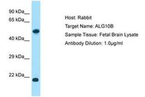 Image no. 1 for anti-Asparagine-Linked Glycosylation 10, alpha-1,2-Glucosyltransferase Homolog B (ALG10B) (AA 104-153) antibody (ABIN6750148) (ALG10B 抗体  (AA 104-153))