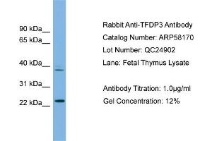 WB Suggested Anti-TFDP3  Antibody Titration: 0. (TFDP3 抗体  (N-Term))