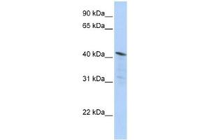 HDAC11 antibody used at 1 ug/ml to detect target protein. (HDAC11 抗体  (Middle Region))