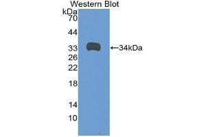 Detection of Recombinant ANGPTL1, Rat using Polyclonal Antibody to Angiopoietin-3 (ANG-3) (Angiopoietin 4 抗体  (AA 36-297))