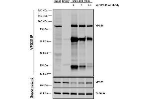 Immunoprecipitation (IP) image for anti-Vacuolar Protein Sorting 35 (VPS35) antibody (FITC) (ABIN6932926)
