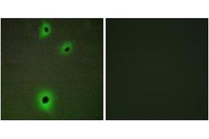 Immunofluorescence analysis of A549 cells, using CADM4 Antibody. (Cell Adhesion Molecule 4 抗体  (AA 339-388))