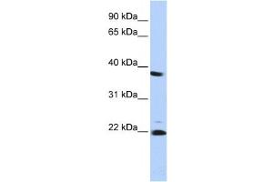 Western Blotting (WB) image for anti-Proteasome (Prosome, Macropain) Subunit, beta Type 2 (PSMB2) antibody (ABIN2459969) (PSMB2 抗体)