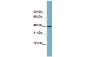 Image no. 1 for anti-Solute Carrier Family 25 (Mitochondrial Carrier: Glutamate), Member 22 (SLC25A22) (AA 71-120) antibody (ABIN6743230)