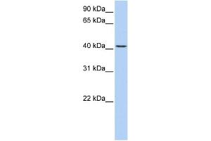 WB Suggested Anti-TMEM144 Antibody Titration:  0. (TMEM144 抗体  (Middle Region))