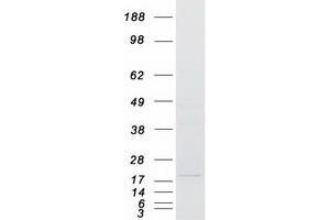 Western Blotting (WB) image for Signal Sequence Receptor gamma (SSRg) protein (Myc-DYKDDDDK Tag) (ABIN2732707)