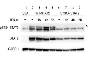 Western Blot of Rabbit anti-STAT2pS734 antibody. (STAT2 抗体  (C-Term, pSer734))
