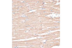 Immunohistochemistry of paraffin-embedded rat heart using ABCB7 antibody (ABIN6291732) at dilution of 1:100 (40x lens). (ABCB7 抗体)