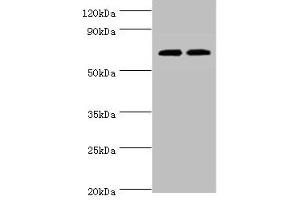 Western blot All lanes: APBB1IP antibody at 4 μg/mL Lane 1: HL60 whole cell lysate Lane 2: Rat spleen tissue Secondary Goat polyclonal to rabbit IgG at 1/10000 dilution Predicted band size: 74, 19 kDa Observed band size: 74 kDa (Amyloid beta (A4) Precursor Protein-Binding, Family B, Member 1 Interacting Protein (APBB1IP) (AA 1-150) 抗体)