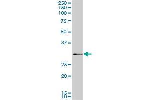 SIX3 monoclonal antibody (M02), clone 3F1. (SIX3 抗体  (AA 273-332))